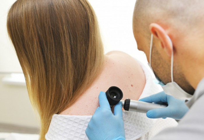 U Srbiji godišnje 250 ljudi premine, a 700 oboli od melanoma - sunce i solarijumi su štetni