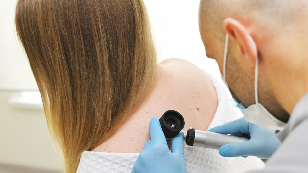 U Srbiji godišnje 250 ljudi premine, a 700 oboli od melanoma - sunce i solarijumi su štetni