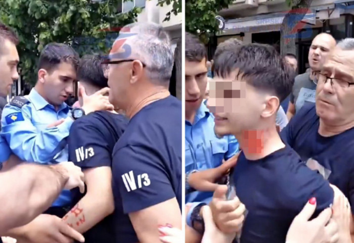 (VIDEO) Incident u Severnoj Mitrovici: Pripadnik kosovske policije povredio srpskog maturanta
