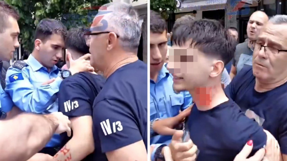 (VIDEO) Incident u Severnoj Mitrovici: Pripadnik kosovske policije povredio srpskog maturanta