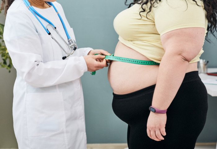 Gojaznost kao epidemija: Da li će za mnoge lekovi postati jedino rešenje u borbi sa viškom kilograma