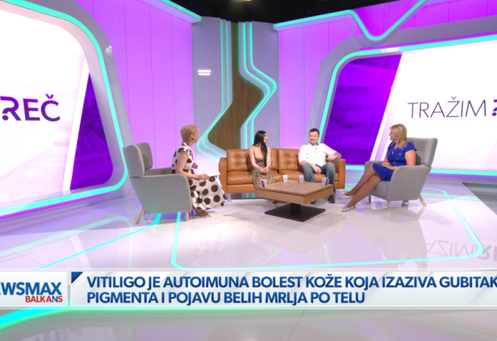 (VIDEO) Vitiligo, život u bojama različitosti: Obeležava telo, ali i samopouzdanje
