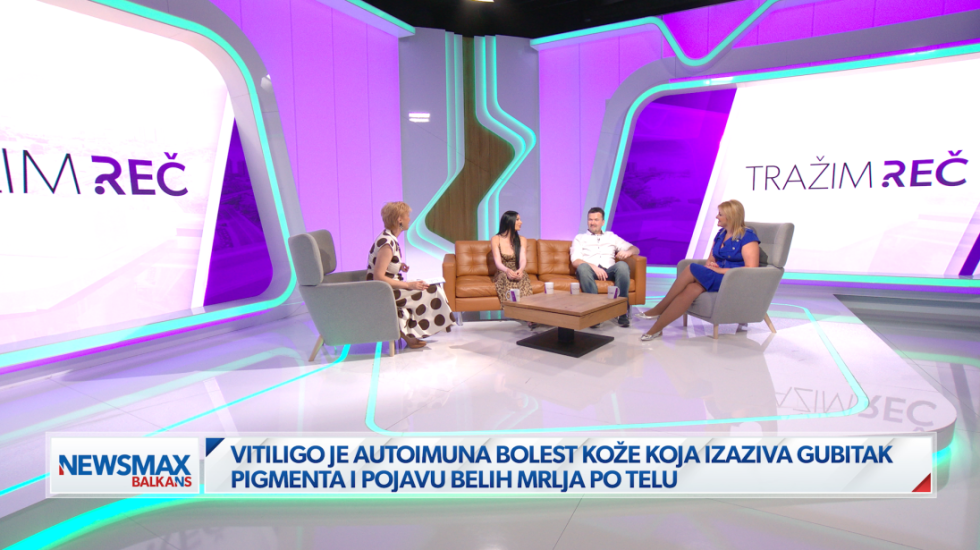 (VIDEO) Vitiligo, život u bojama različitosti: Obeležava telo, ali i samopouzdanje