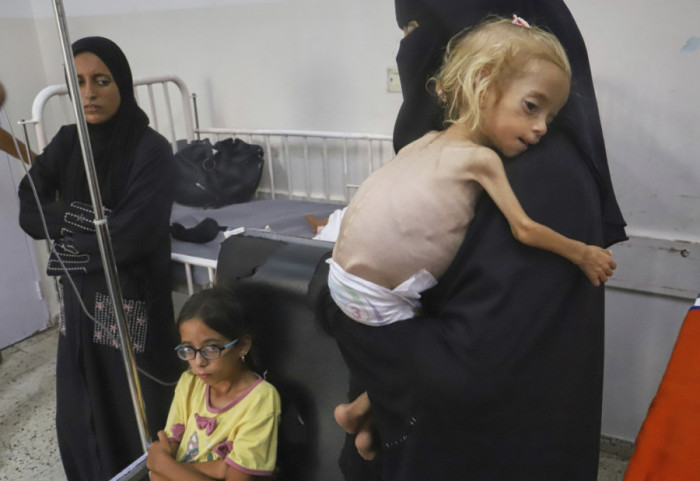 Lazarini: Gaza je pakao u svim oblicima, glad je poslednja nesreća