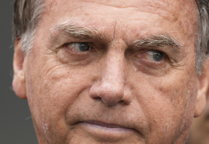 Bivši predsednik Brazila Žair Bolsonaro ima rak kože, potvrdili lekari