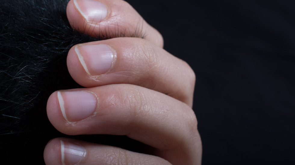 Promene na noktima mogu ukazivati na ozbiljne zdravstvene probleme: Reagujte na vreme