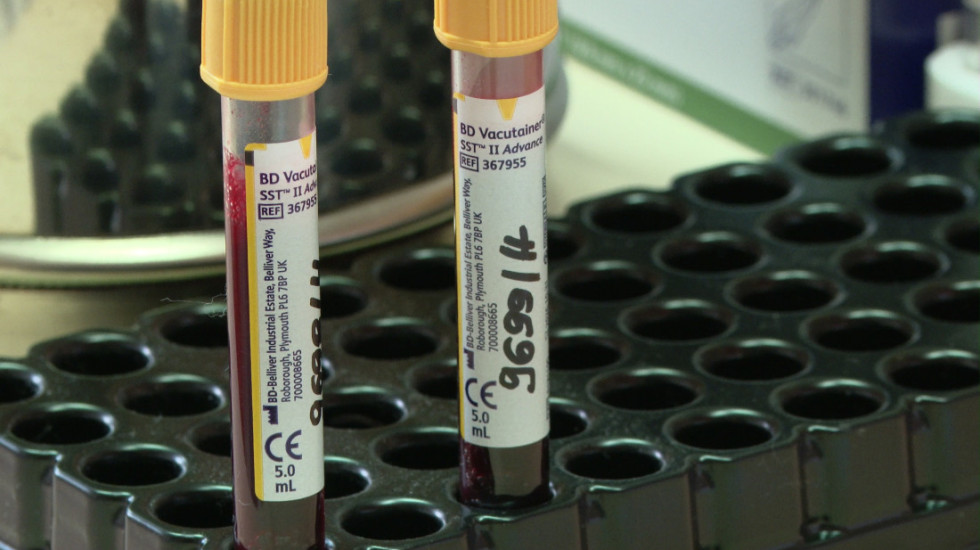 Deca obolela od talasemije zarazila se virusom HIV nakon transfuzije krvi