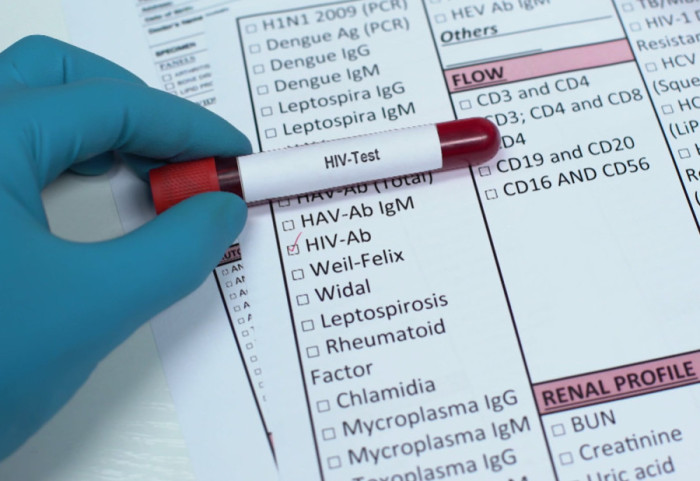 "Najmlađa osoba zaražena HIV ima 17, a najstarija 79 godina": Virus često bez simptoma, testiranje spasava život