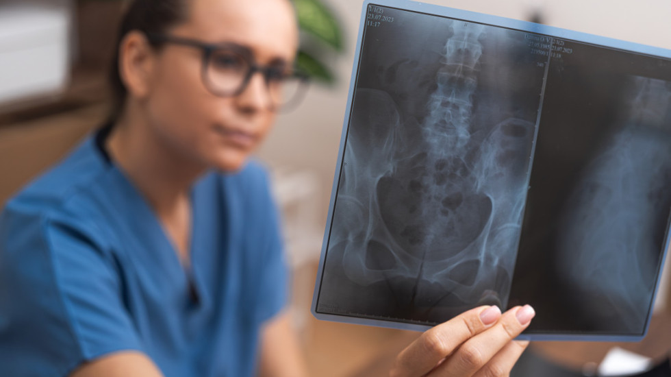 Mikroplastika detektovana i u ljudskim kostima: Da li je ovo skriveni faktor koji slabi naš skelet