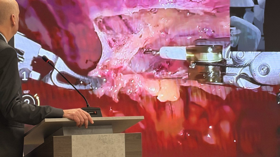 Na Institutu Dedinje izvedena prva robotski asistirana operacija na srcu