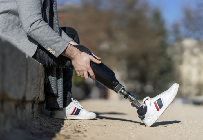 Britanac sam napravio protezu za nogu, uštedeo više od 40.000 evra