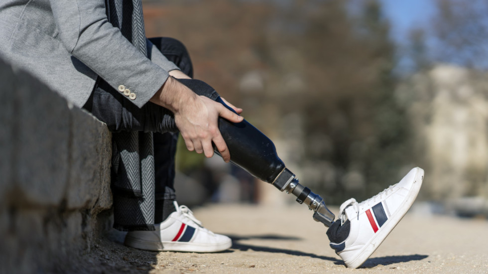 Britanac sam napravio protezu za nogu, uštedeo više od 40.000 evra