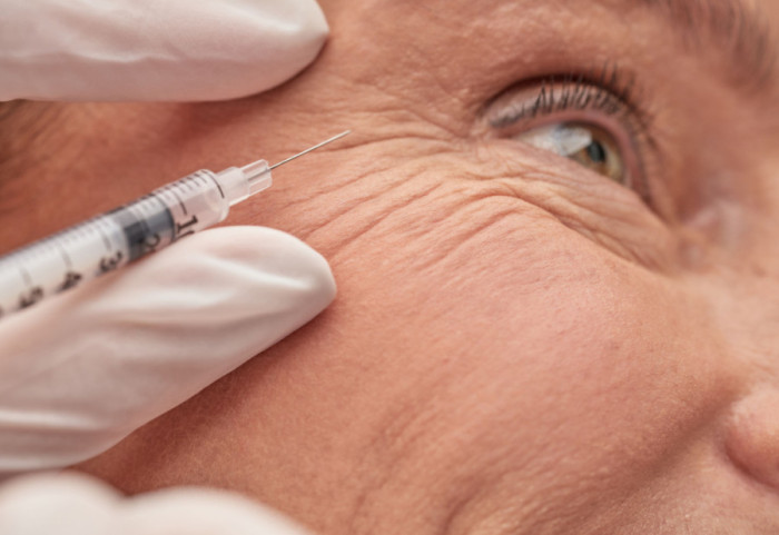 Britanka (87) daje 343.000 evra za podmlađivanje u Panami