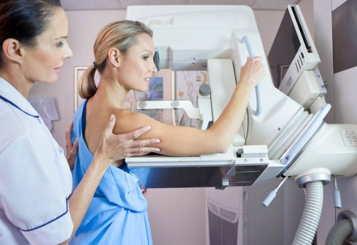 Besplatna mamografija od 7. do 9. marta kod stadiona "Rajko Mitić": Pregled mogu da urade žene od 45 do 69 godina