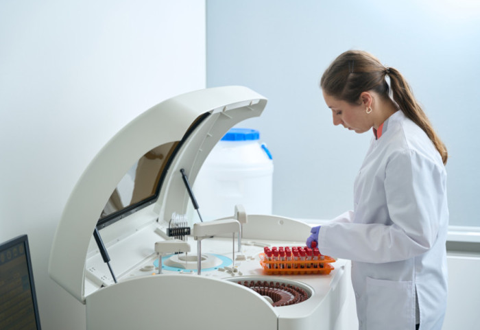 Nove smernice za kontrolu holesterola: Rani skrining i prevencija u fokusu